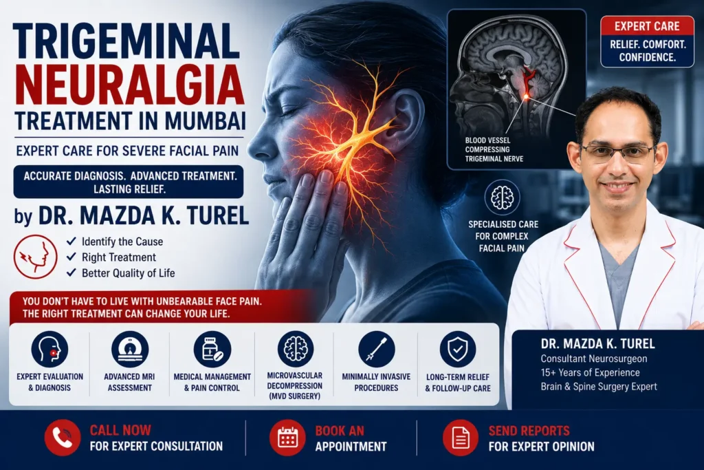 Trigeminal Neuralgia Treatment