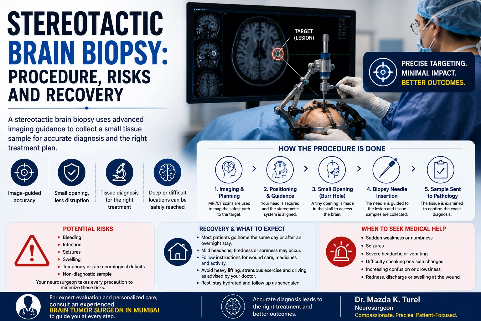 Stereotactic Brain Biopsy: Procedure, Risks and Recovery