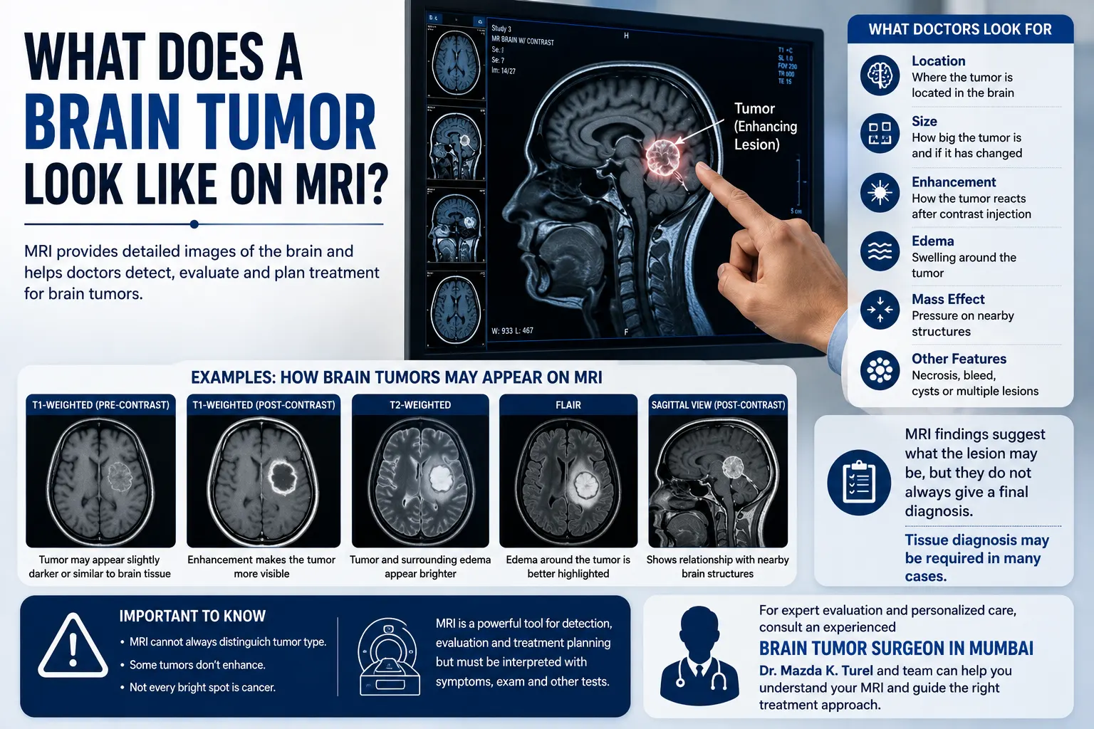 What Does a Brain Tumor Look Like on MRI?