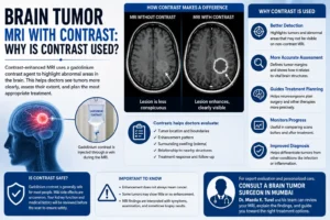 Brain Tumor MRI With Contrast: Why Is Contrast Used?