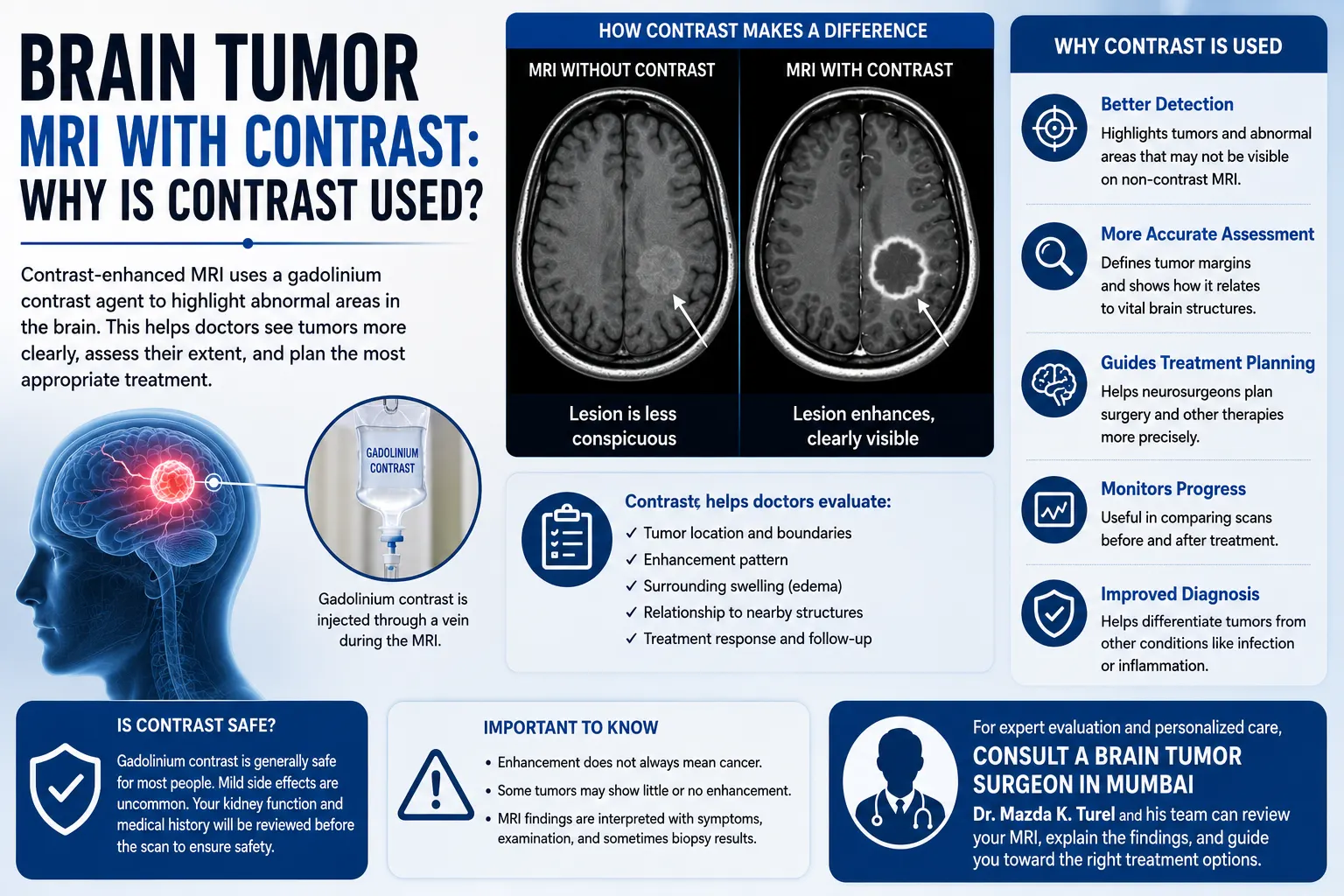Brain Tumor MRI With Contrast: Why Is Contrast Used?